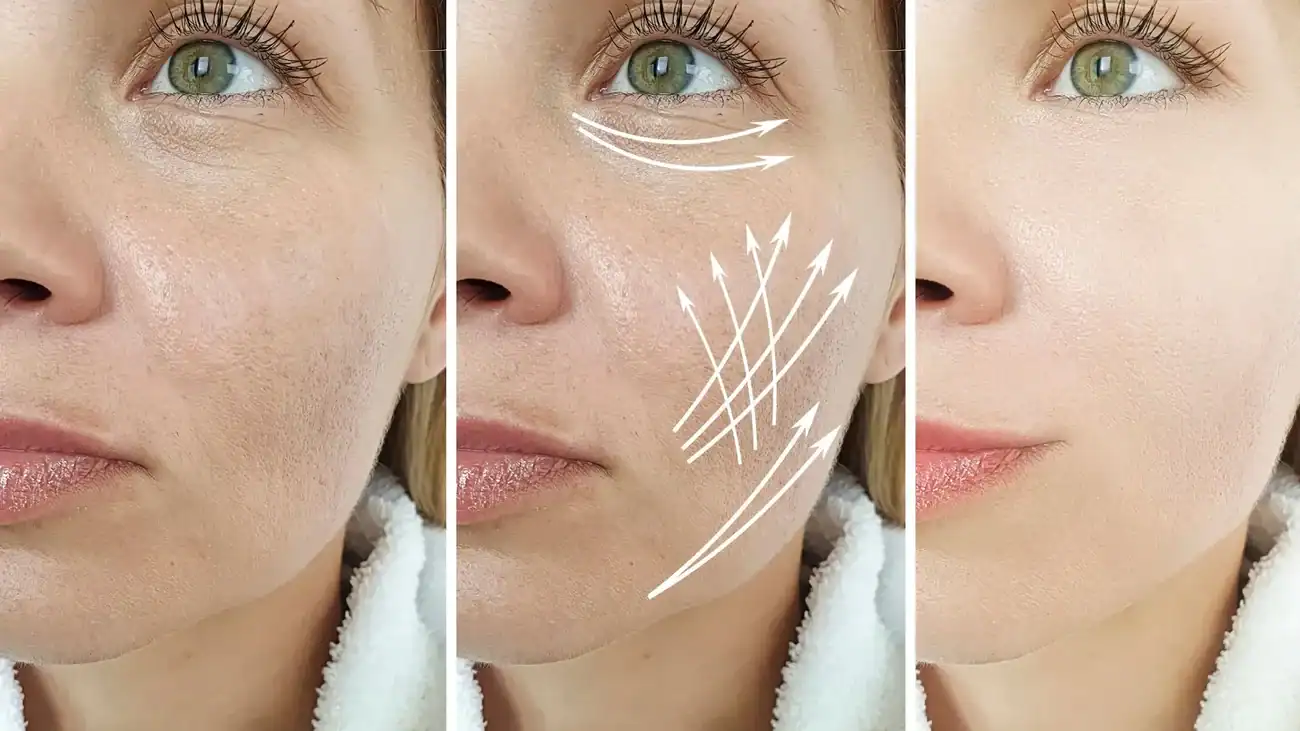 Can One Treatment Really Tackle More Than One Skin Concern Peterborough?