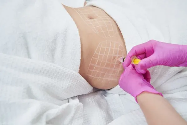 image of fat dissolving injections on love handles to help combat weight gain Peterborough
