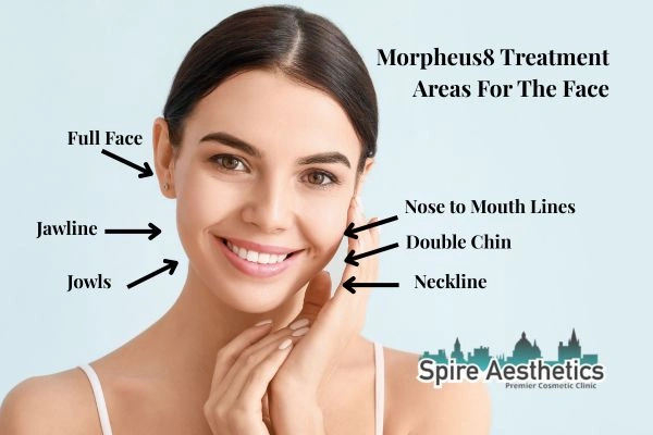 Where can Morpheus8 Treatment Peterborough be done on the body?