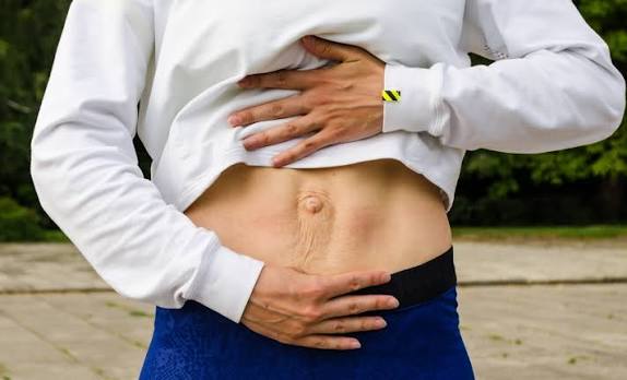 When Could Diastasis Recti Be the Missing Piece of the Puzzle Peterborough?
